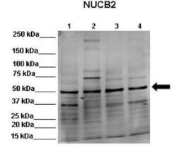 Nesfatin-1/Nucleobindin-2 Antibody, Novus Biologicals 0.1mg; Unlabeled:Antibodies,